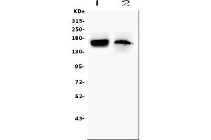 Western blot analysis of TEK using anti-TEK antibody (ABIN7600762). (TEK antibody  (AA 23-616))