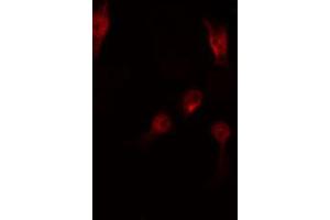 ABIN6267513 staining RAW264. (STAT5 A/B antibody  (pSer725, pSer730))