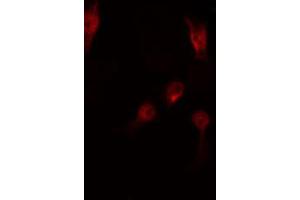 ABIN6267513 staining RAW264. (STAT5 A/B antibody  (pSer725, pSer730))