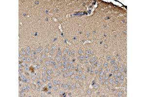 IHC analysis of SRP72 using anti-SRP72 antibody (ABIN7601648).