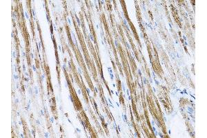Immunohistochemistry of paraffin-embedded rat spleen using β-actin antibody.