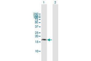 Western Blot analysis of PMAIP1 expression in transfected 293T cell line by PMAIP1 MaxPab polyclonal antibody. (NOXA antibody  (AA 1-136))