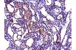 Formalin-fixed and paraffin embedded rat kidney tissue labeled with Anti-SCF Polyclonal Antibody (ABIN669936), Unconjugated at 1:200, followed by conjugation to the secondary antibody and DAB staining (KIT Ligand antibody  (AA 151-250))