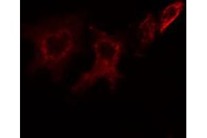 ABIN6266883 staining HeLa cells by IF/ICC. (ITPK1 antibody  (Internal Region))