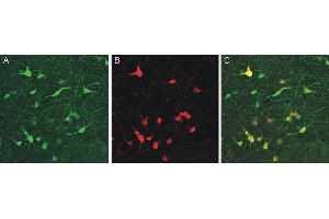 Immunohistochemistry (IHC) image for anti-Calbindin (CALB1) (AA 3-251) antibody (ABIN1742425) (CALB1 antibody  (AA 3-251))