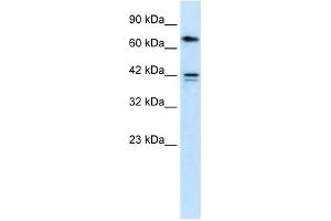 Western Blotting (WB) image for anti-Calcium Channel, Voltage-Dependent, beta 1 Subunit (CACNB1) (N-Term) antibody (ABIN633640)