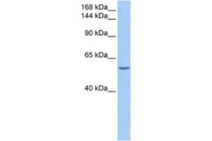 Western Blotting (WB) image for anti-Deleted in Liver Cancer 1 (DLC1) antibody (ABIN2463497) (DLC1 antibody)
