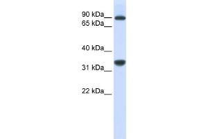 WB Suggested Anti-RRP1B  Antibody Titration: 0. (RRP1B antibody  (Middle Region))