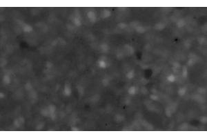 Image of the maximum plot of the fluorescence intensity (F/F0) of a Fluo3-stained culture of SiMa human neuroblastoma cells pretreated for 12 h with 10 μg/ml of α-CJe, and subsequently perfused for 50 s with 10 nmol/l of ACh in standard bath solution. (Campylobacter jejuni antibody)