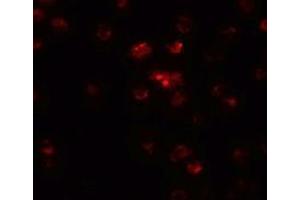 Immunofluorescence of TSHZ2 in A20 cells with TSHZ2 antibody at 20 µg/ml. (TSHZ2 antibody  (N-Term))