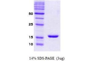 Figure annotation denotes ug of protein loaded and % gel used. (SNCA Protein)
