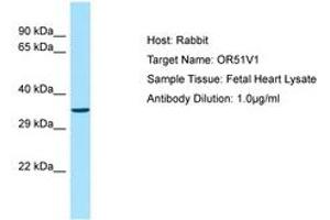 Image no. 1 for anti-Olfactory Receptor, Family 51, Subfamily V, Member 1 (OR51V1) (N-Term) antibody (ABIN6749902)