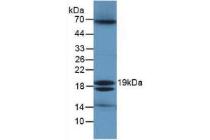 Figure. (Ecotin (AA 21-162) antibody)