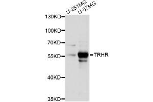Western blot analysis of extracts of various cell lines, using TRHR antibody (ABIN6292313) at 1:1000 dilution. (TRHR antibody)