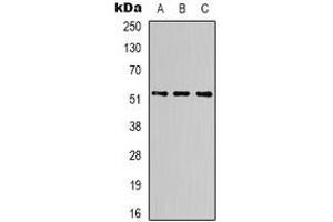 Western blot analysis of Alpha-tubulin expression in Hela (A), mouse brain (B), rat brain (C) whole cell lysates.
