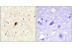 Immunohistochemistry analysis of paraffin-embedded human brain, using GluR4 (Phospho-Ser862) Antibody.