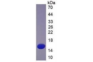SDS-PAGE (SDS) image for Thioredoxin (TXN) (AA 1-105) protein (His tag) (ABIN1080900)