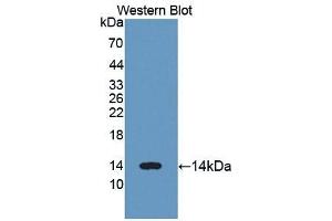 Detection of Recombinant LZM, Human using Polyclonal Antibody to Lysozyme (LZM) (LYZ antibody  (AA 24-144))