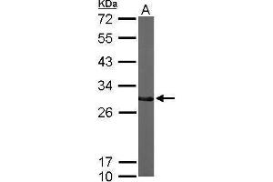 WB Image Sample (50 ug of whole cell lysate) A: Mouse brain 12% SDS PAGE antibody diluted at 1:1000 (CTDSP2 antibody  (Center))