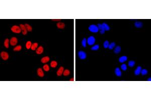 MCF-7 cells were stained with FOXA1 (5F7) Monoclonal Antibody  at 1:200 dilution, incubated overnight at 4C, followed by secondary antibody incubation, DAPI staining of the nuclei and detection. (FOXA1 antibody)