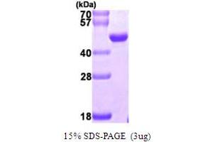 SDS-PAGE (SDS) image for Nudix (Nucleoside Diphosphate Linked Moiety X)-Type Motif 9 (NUDT9) (AA 47-350) protein (His tag) (ABIN667452) (NUDT9 Protein (AA 47-350) (His tag))