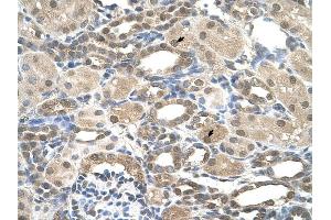 Presenilin 2 antibody was used for immunohistochemistry at a concentration of 4-8 ug/ml to stain Epithelial cells of renal tubule (arrows) in Human Kidney. (Presenilin 2 antibody)