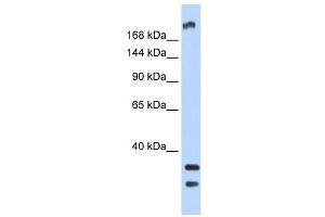 Western Blot showing TRPM2 antibody used at a concentration of 1 ug/ml against Fetal Brain Lysate (TRPM2 antibody  (N-Term))