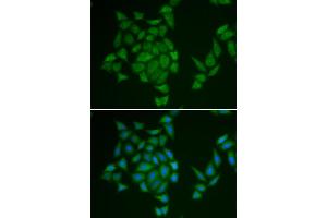 Immunofluorescence analysis of HeLa cells using AMPD3 antibody (ABIN6290008).