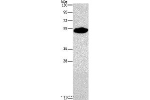 Western blot analysis of Mouse heart tissue, using SMAD9 Polyclonal Antibody at dilution of 1:290 (SMAD9 antibody)