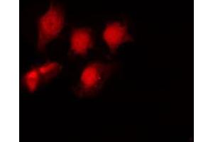 ABIN6267694 staining NIH-3T3 by IF/ICC. (HDAC6 antibody  (pSer22))