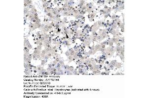 Human Liver (ZNF654 antibody  (Middle Region))