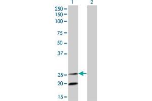 Western Blot analysis of IL6 expression in transfected 293T cell line by IL6 monoclonal antibody (M04), clone 3G6. (IL-6 antibody  (AA 29-212))