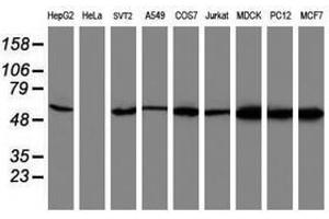 Image no. 1 for anti-V-Akt Murine Thymoma Viral Oncogene Homolog 1 (AKT1) antibody (ABIN1496557) (AKT1 antibody)