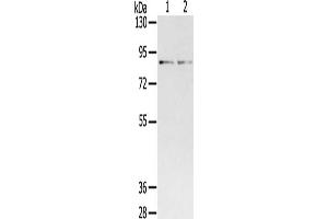 Gel: 6 % SDS-PAGE, Lysate: 40 μg, Lane 1-2: Mouse brain tissue, Mouse lung tissue, Primary antibody: ABIN7192633(SPON1 Antibody) at dilution 1/400, Secondary antibody: Goat anti rabbit IgG at 1/8000 dilution, Exposure time: 2 minutes