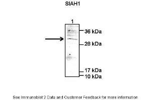 Lanes:   Lane1: 50 ug human HEK-293T lysate  Primary Antibody Dilution:   1:1000  Secondary Antibody:   Anti-rabbit-IgG  Secondary Antibody Dilution:   1:5000  Gene Name:   SIAH1  Submitted by:   Peter Brand & Dr. (SIAH1 antibody  (C-Term))