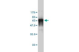 Western Blotting (WB) image for anti-Protein Kinase, AMP-Activated, beta 1 Non-Catalytic Subunit (PRKAB1) (AA 1-270) antibody (ABIN562363)
