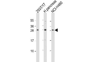 Western Blot at 1:1000 dilution Lane 1: 293T/17 whole cell lysate Lane 2: human pancreas lysate Lane 3: NCI-H460 whole cell lysate Lysates/proteins at 20 ug per lane. (COMTD1 antibody  (C-Term))
