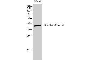 Western Blotting (WB) image for anti-Activating Transcription Factor 4 (Tax-Responsive Enhancer Element B67) (ATF4) (pSer219) antibody (ABIN3173148) (ATF4 antibody  (pSer219))