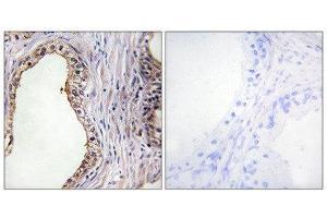 Immunohistochemistry (IHC) image for anti-Lecithin Retinol Acyltransferase (Phosphatidylcholine--Retinol O-Acyltransferase) (LRAT) (Internal Region) antibody (ABIN1849060) (LRAT antibody  (Internal Region))
