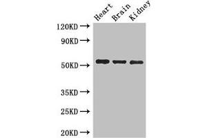 Western Blot Positive WB detected in: Mouse heart tissue, Mouse brain tissue, Mouse kidney tissue All lanes: SH3BP5 antibody at 3 μg/mL Secondary Goat polyclonal to rabbit IgG at 1/50000 dilution Predicted band size: 51, 33 kDa Observed band size: 51 kDa (SH3BP5 antibody  (AA 49-455))