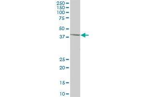 SCCPDH MaxPab polyclonal antibody. (SCCPDH antibody  (AA 1-429))