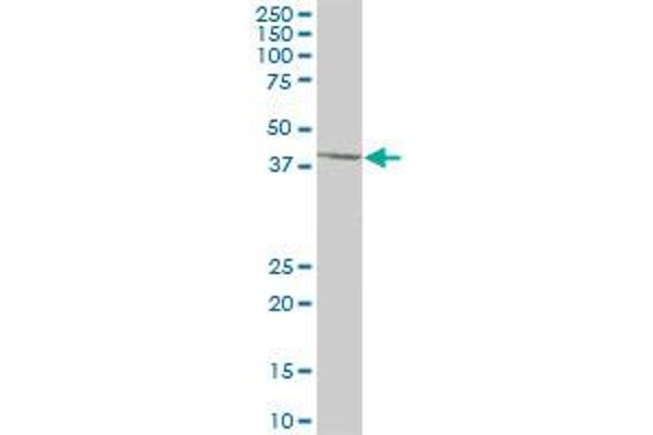 SCCPDH antibody  (AA 1-429)