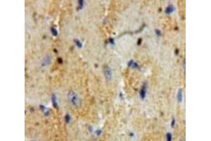 #VALUE! (Cardiac Troponin T2 antibody  (AA 2-100))