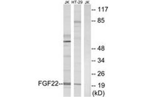 Western blot analysis of extracts from Jurkat/HT-29 cells, using FGF22 Antibody. (FGF22 antibody  (AA 71-120))
