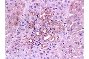 Formalin-fixed and paraffin embedded rabbit cartilage tissue with Anti-Collagen IV Polyclonal Antibody, Unconjugated (ABIN728413) at 1:200, followed by conjugation to the secondary antibody and DAB staining (Collagen IV antibody  (AA 1401-1500))