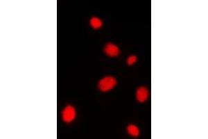 Immunofluorescent analysis of AKAP8 staining in Jurkat cells. (AKAP8 antibody  (Center))