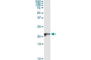 Immunoprecipitation of COX4I2 transfected lysate using anti-COX4I2 monoclonal antibody and Protein A Magnetic Bead , and immunoblotted with COX4I2 MaxPab rabbit polyclonal antibody. (COX4I2 antibody  (AA 21-104))