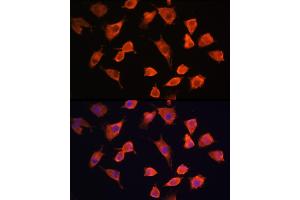 Immunofluorescence analysis of L929 cells using PFDN5 Rabbit pAb (ABIN1681328, ABIN3018415, ABIN3018416 and ABIN6220463) at dilution of 1:100 (40x lens).