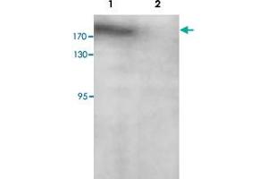 Western blot analysis of SK-OV-3 cell lysate with PARP14 polyclonal antibody  at 1 : 200 dilution.