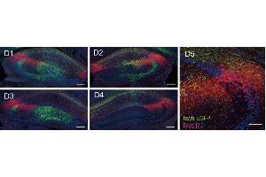 Representative confocal serial sections of hippocampus infected with AAV9/hSyn-Cre & AAV9/EF1α-DIO-EGFP (green) in dCA2 and stained with RGS14 ((ABIN1304934), 1:500, red). (RGS14 antibody  (AA 1-544))